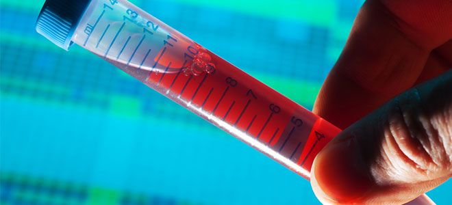 Εξετάσεις αίματος: Να τι σημαίνει κάθε εξέταση στη γενική αίματος και τι να κοιτάς