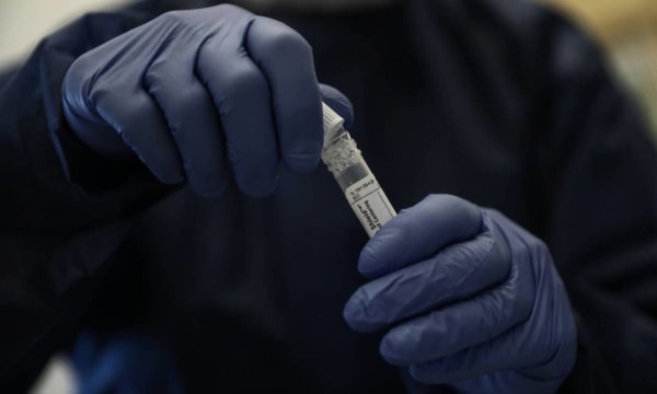 Η ηπατίτιδα θερίζει την Ευρώπη: Πάσχουν 5 εκατ. άνθρωποι, έξι στους δέκα δεν το ξέρουν