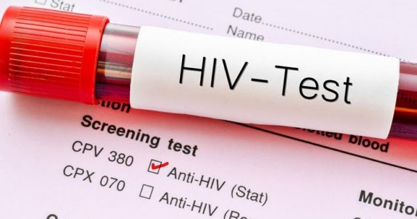 Φάρμακο κατά του HIV διαθέσιμο σε φθηνότερη τιμή από το 2027 σε χώρες χαμηλού εισοδήματος – Από 26.000 ευρώ μόλις 37