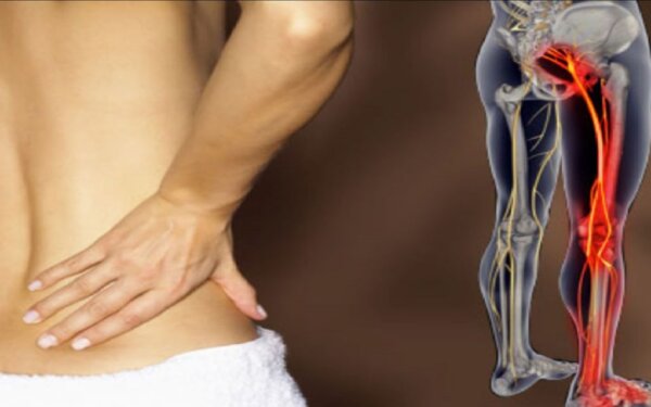 Τι προκαλεί πόνο κάτω δεξιά στην πλάτη – Πότε είναι λόγος ανησυχίας